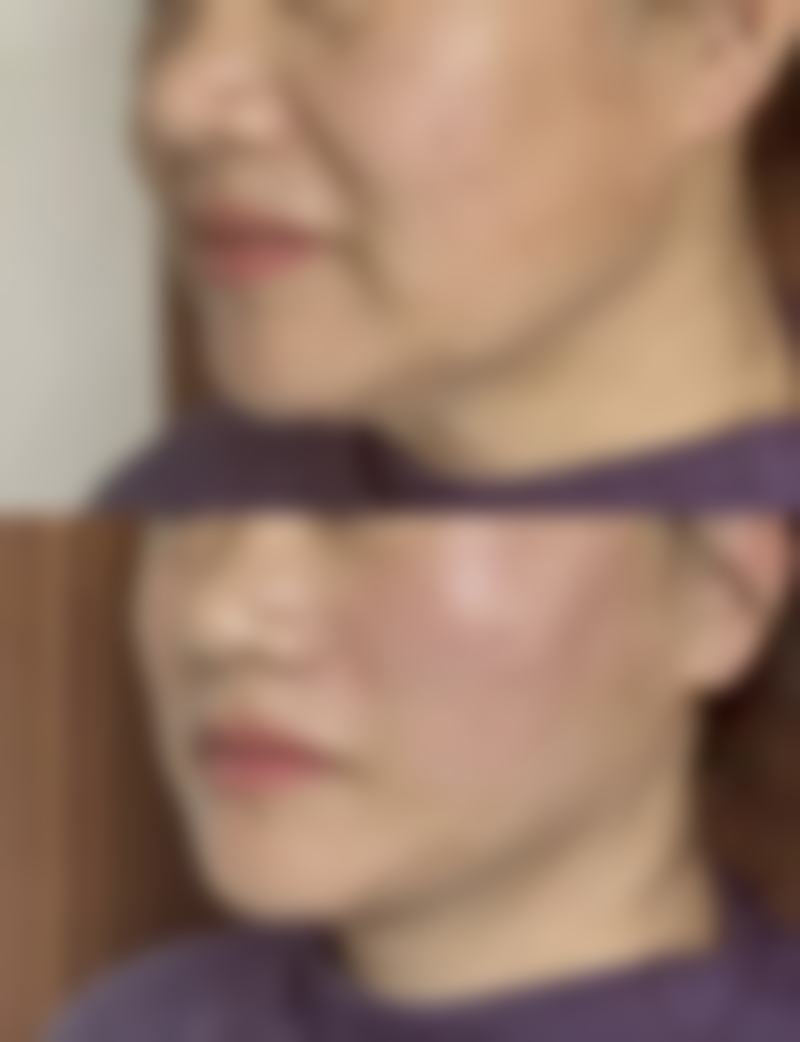 韓國普拉美斯醫院怎麼預約掛號：3大正規渠道+詳細流程