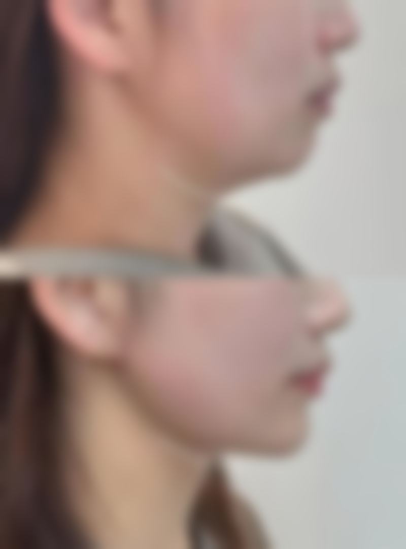韓國普拉美斯醫院怎麼預約掛號：適合邊類人群？