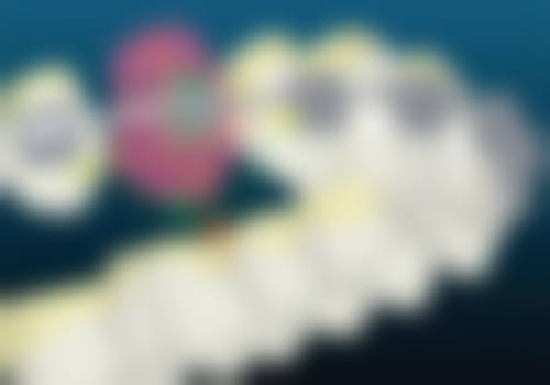 4、梅州美雅口腔重点诊疗项目及技术优势