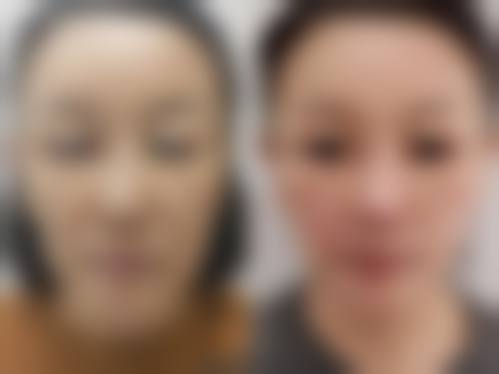医生团队:经验多的守护者,为你的美丽之路全程护航