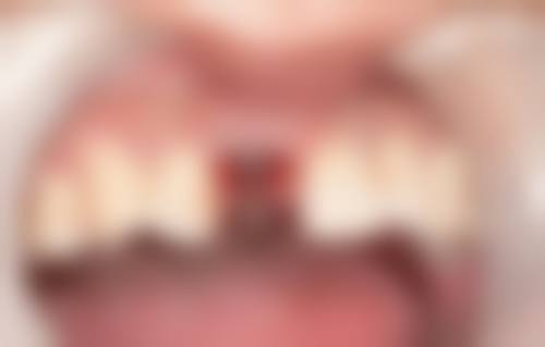 找武汉存济口腔医院向国林医生看牙,患者口碑如何?