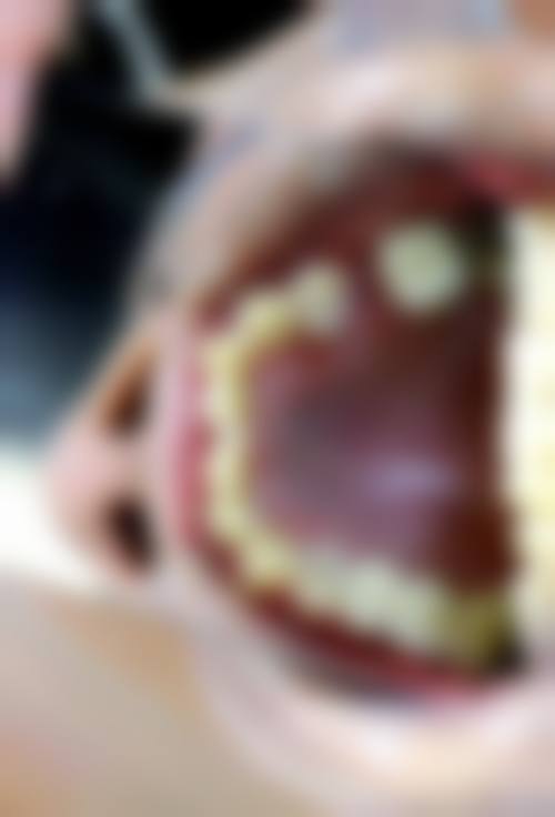 山西临汾士钧齿科的收费价格贵不贵?