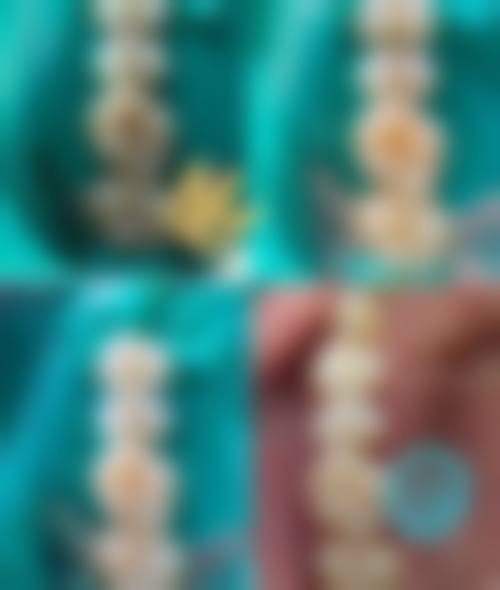 山西临汾士钧齿科的患者口碑如何?