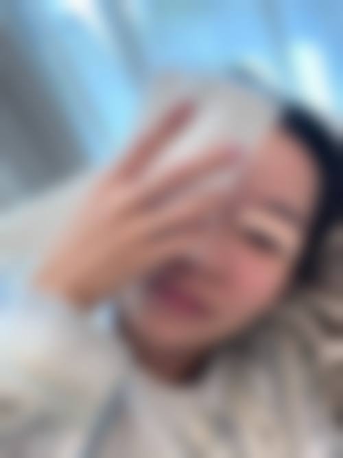 二、影响切开双眼皮修复时间的因素