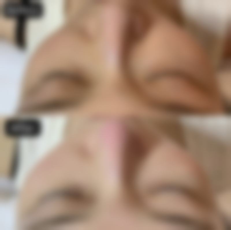 济南美辰医疗美容门诊部擅长哪些项目?总有一项适合你